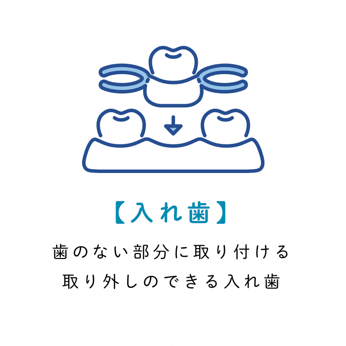 【入れ歯】 歯のない部分に取り付ける取り外しのできる入れ歯